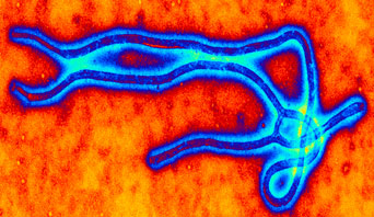 Global Ebola Response Found Inadequate